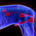 mangimi renal calcoli struvite cane