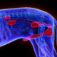 mangimi renal calcoli struvite cane